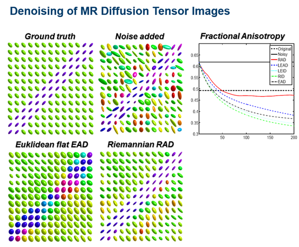 Denoising of MR Diffusion Tensor Images